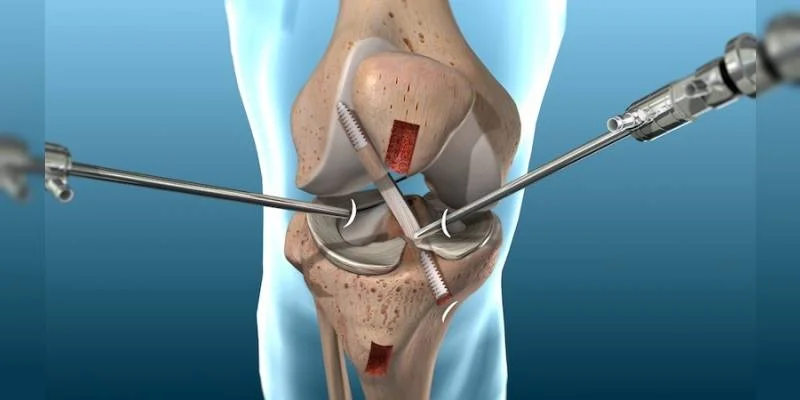Best Arthroscopy Surgeon in Ahmedabad
