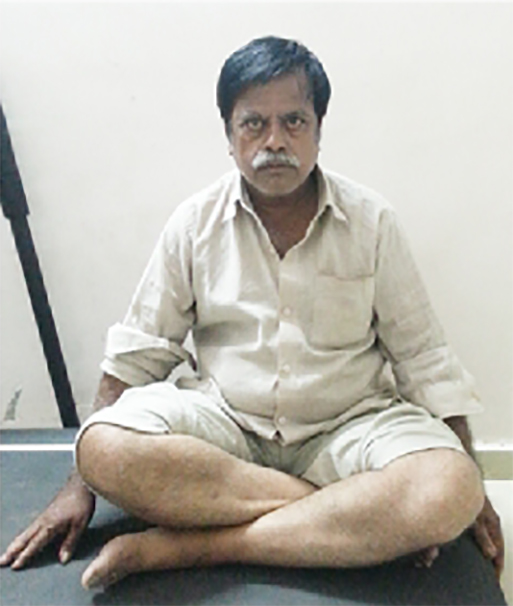 Knee replacement case 6