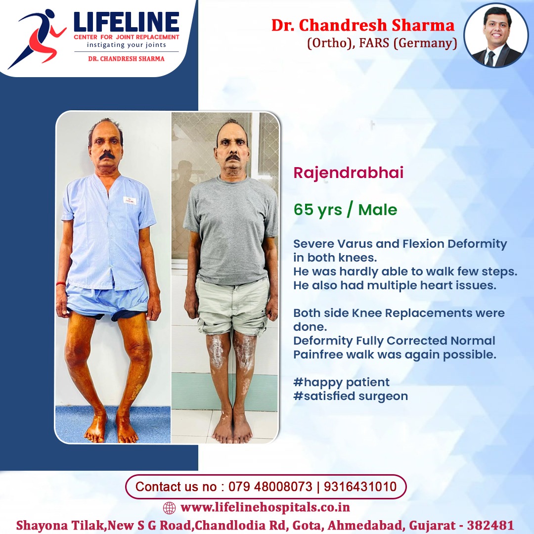 Patient treated by Dr. Chandresh Sharma, photo 26