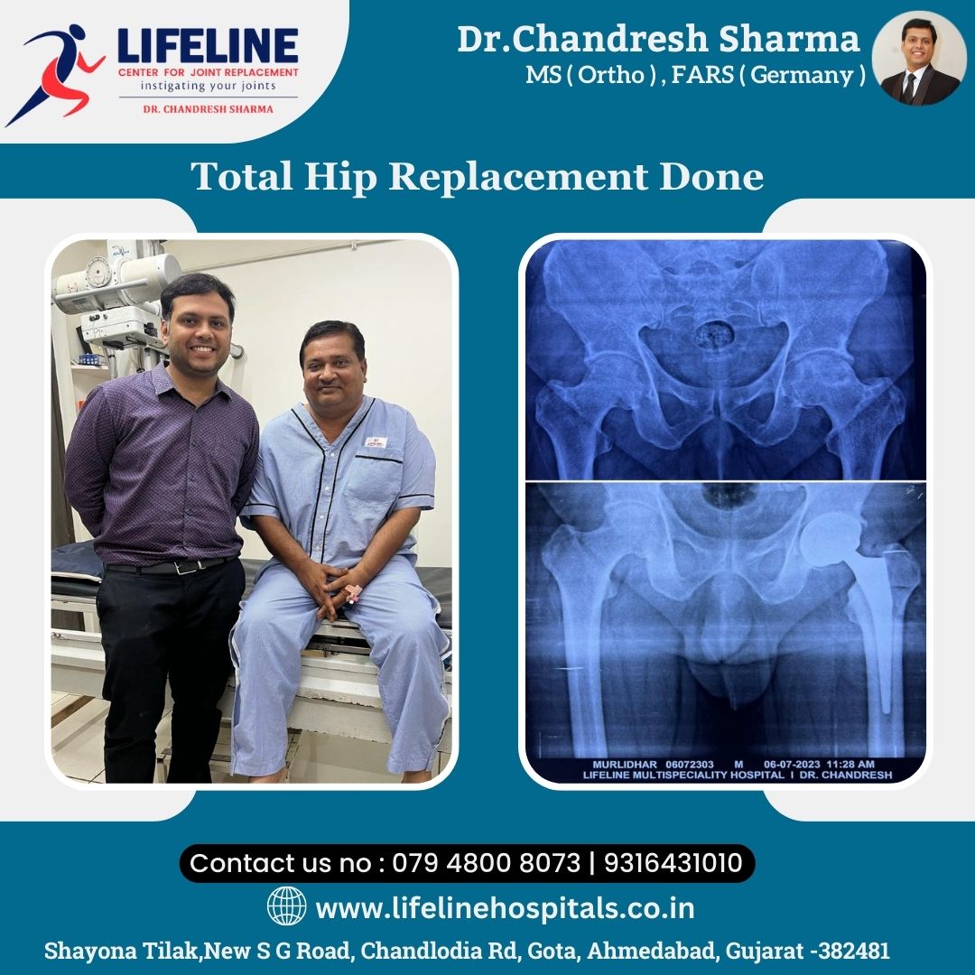 Patient treated by Dr. Chandresh Sharma, photo 29