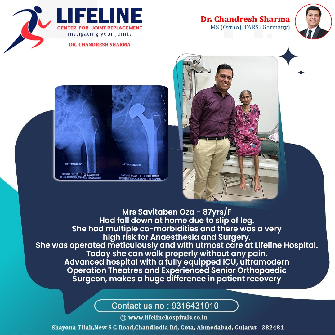 Patient treated by Dr. Chandresh Sharma, photo 35