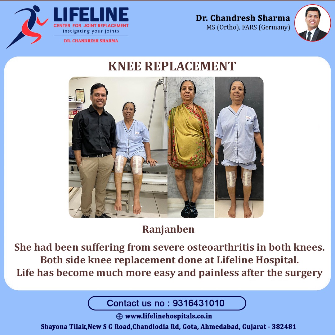 Patient treated by Dr. Chandresh Sharma, photo 37
