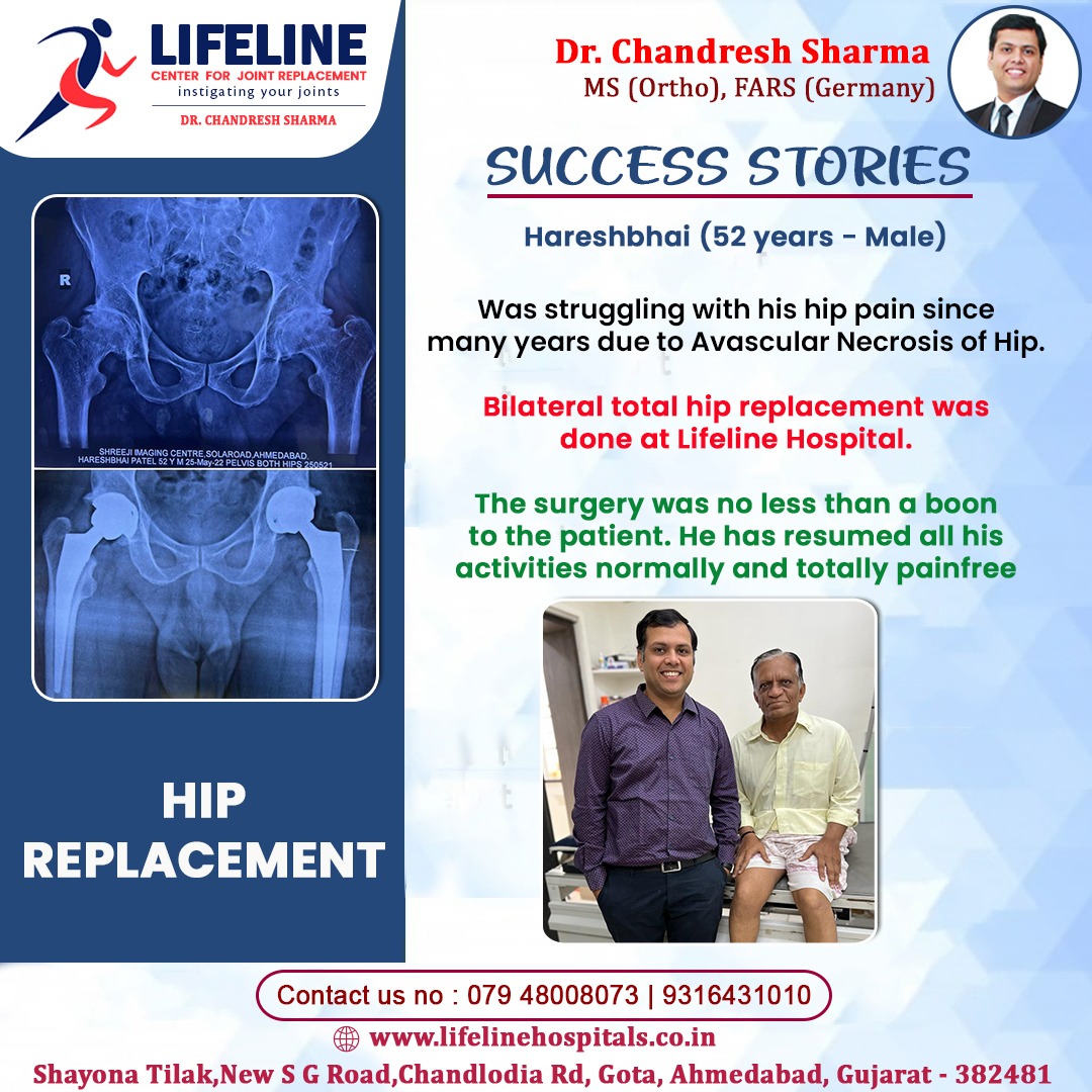 Patient treated by Dr. Chandresh Sharma, photo 40