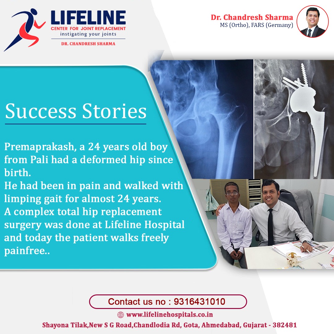 Patient treated by Dr. Chandresh Sharma, photo 46