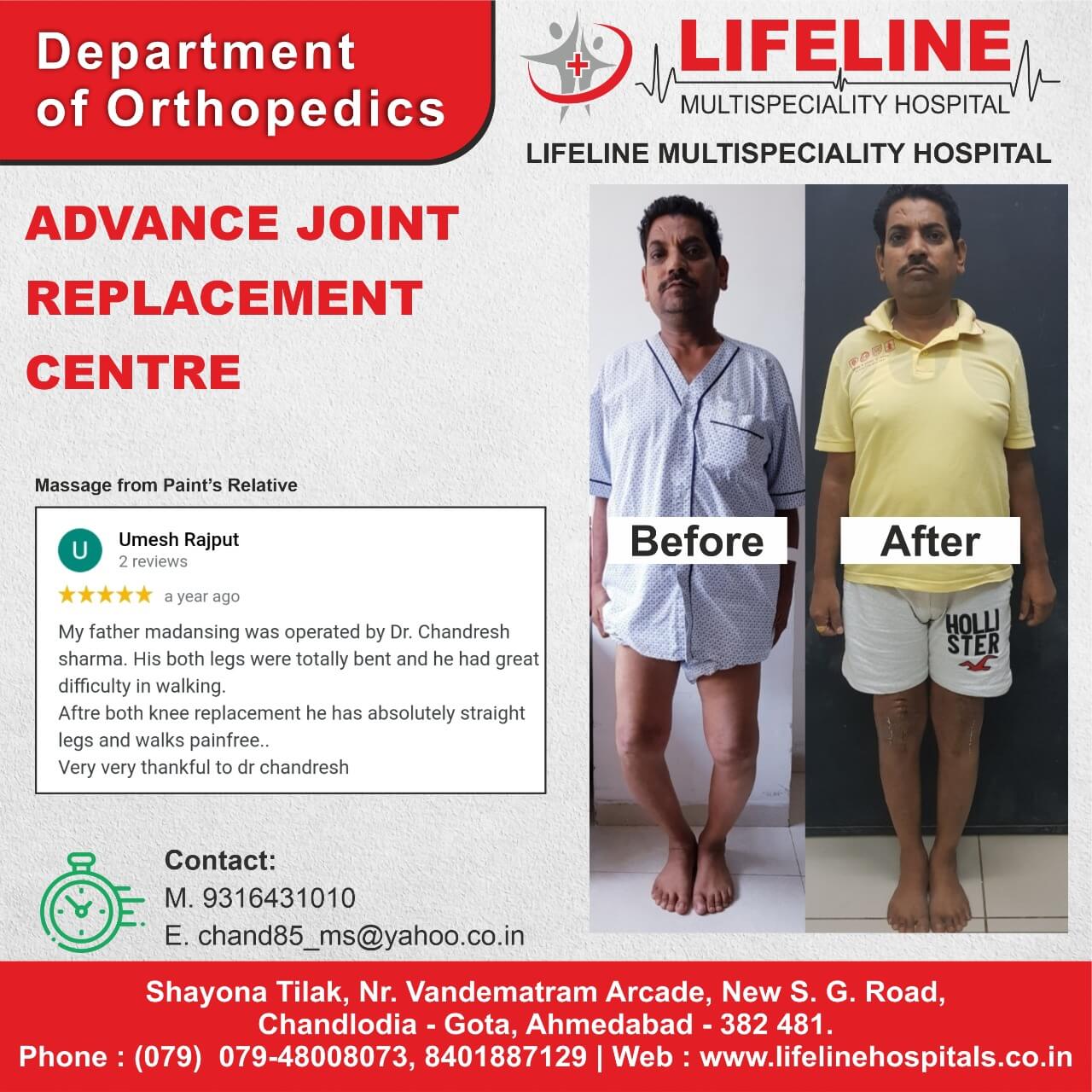 Patient treated by Dr. Chandresh Sharma, photo 81