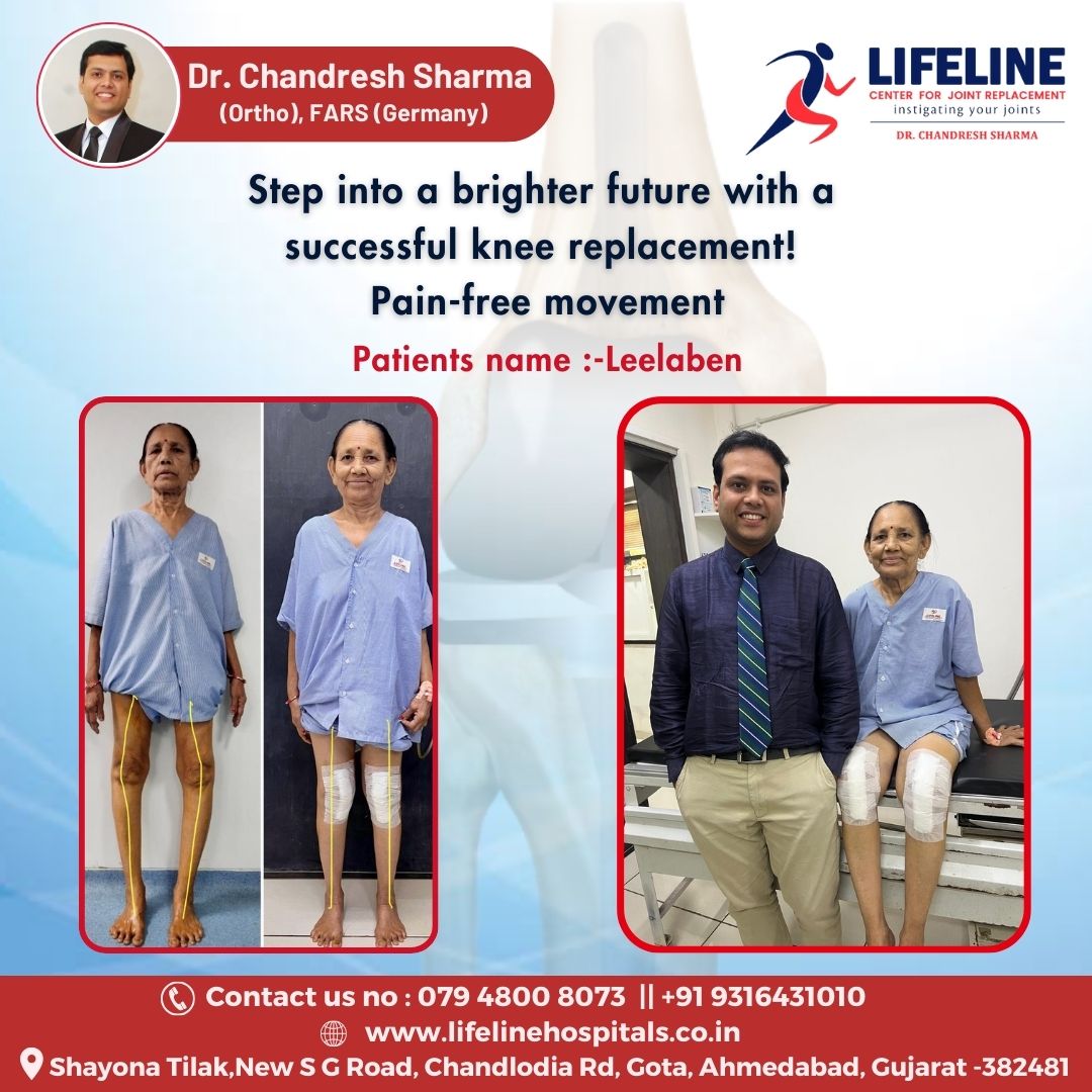 Patient treated by Dr. Chandresh Sharma, photo 9