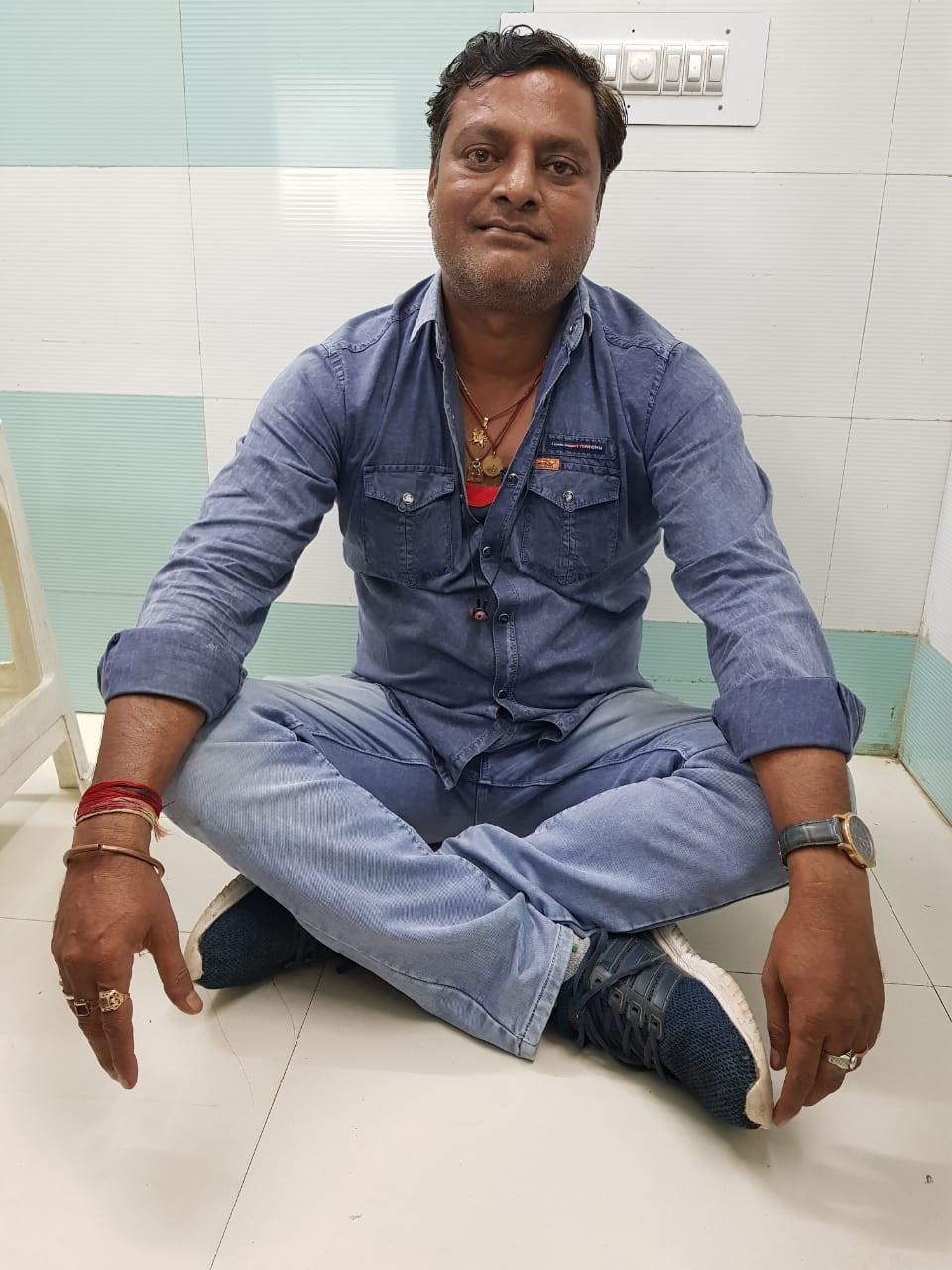 Bilateral hip replacement, treated case 4