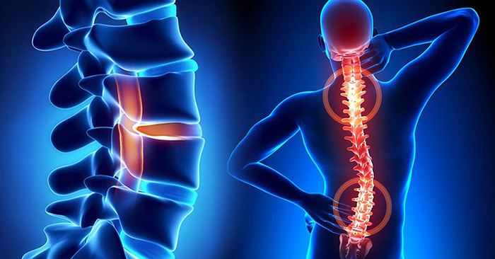 joint-replacement